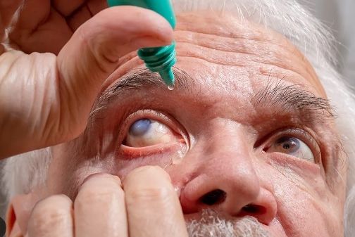 Maio verde: especialista alerta para diagnóstico precoce do glaucoma